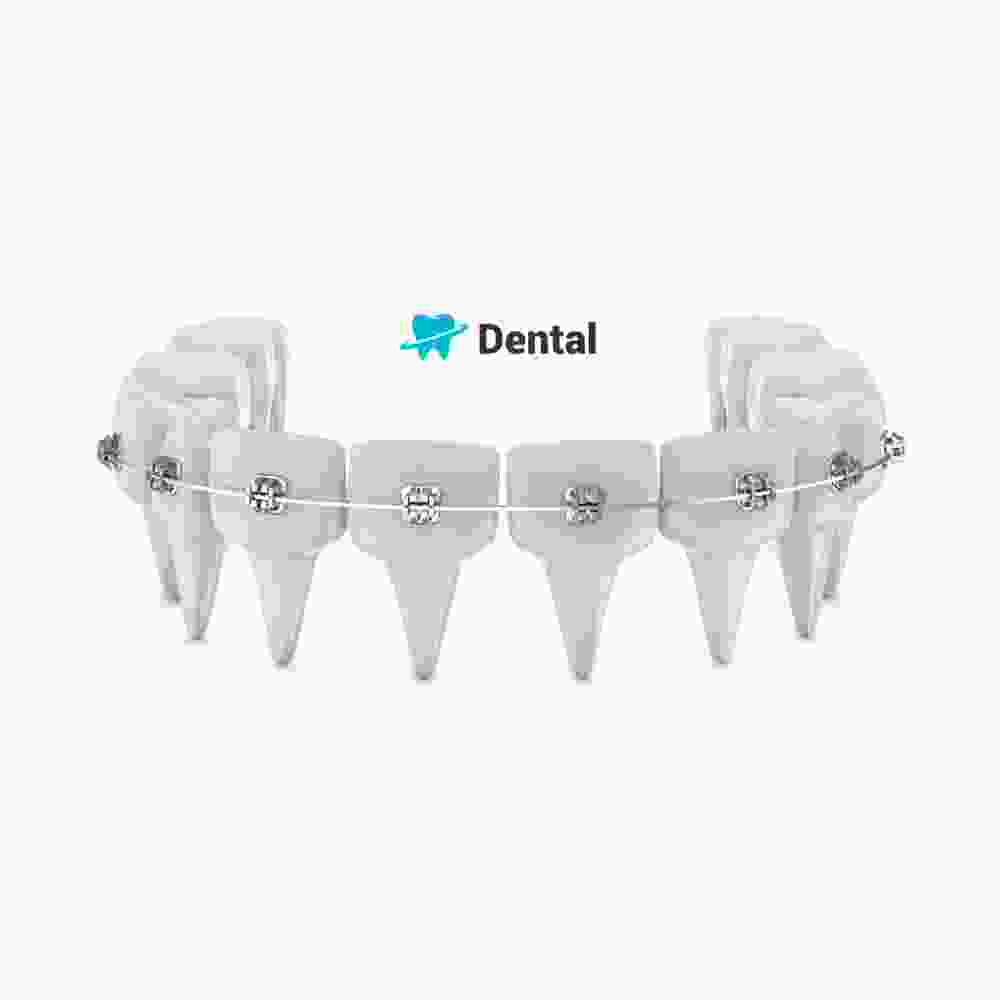 Braces