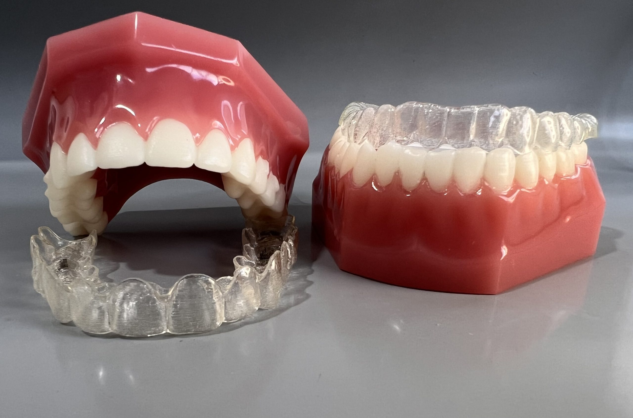 Orto invisalign 1
